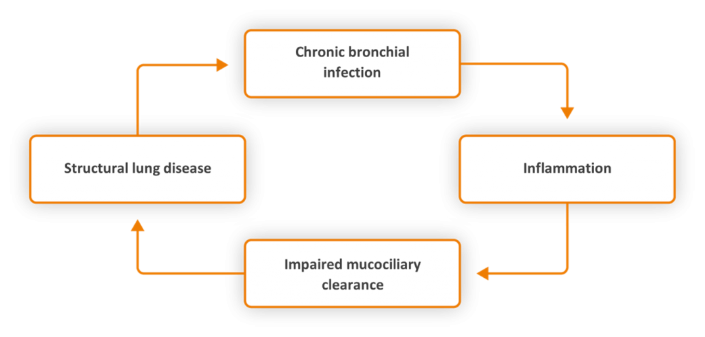 The ‘vicious cycle’ concept of bronchiectasis