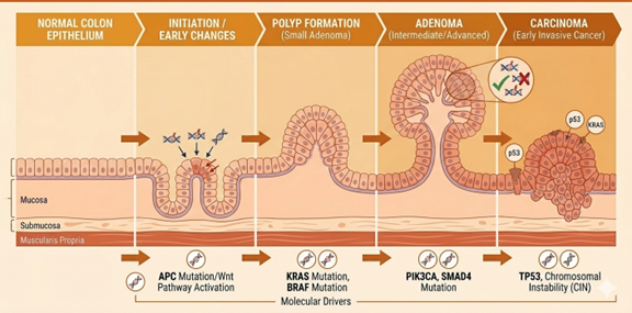 Diagram if CRC disease mechanism