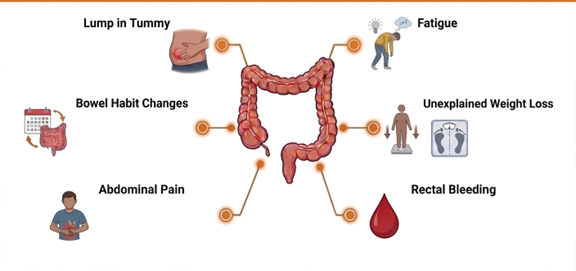 Diagram showing the common symptoms of CRC